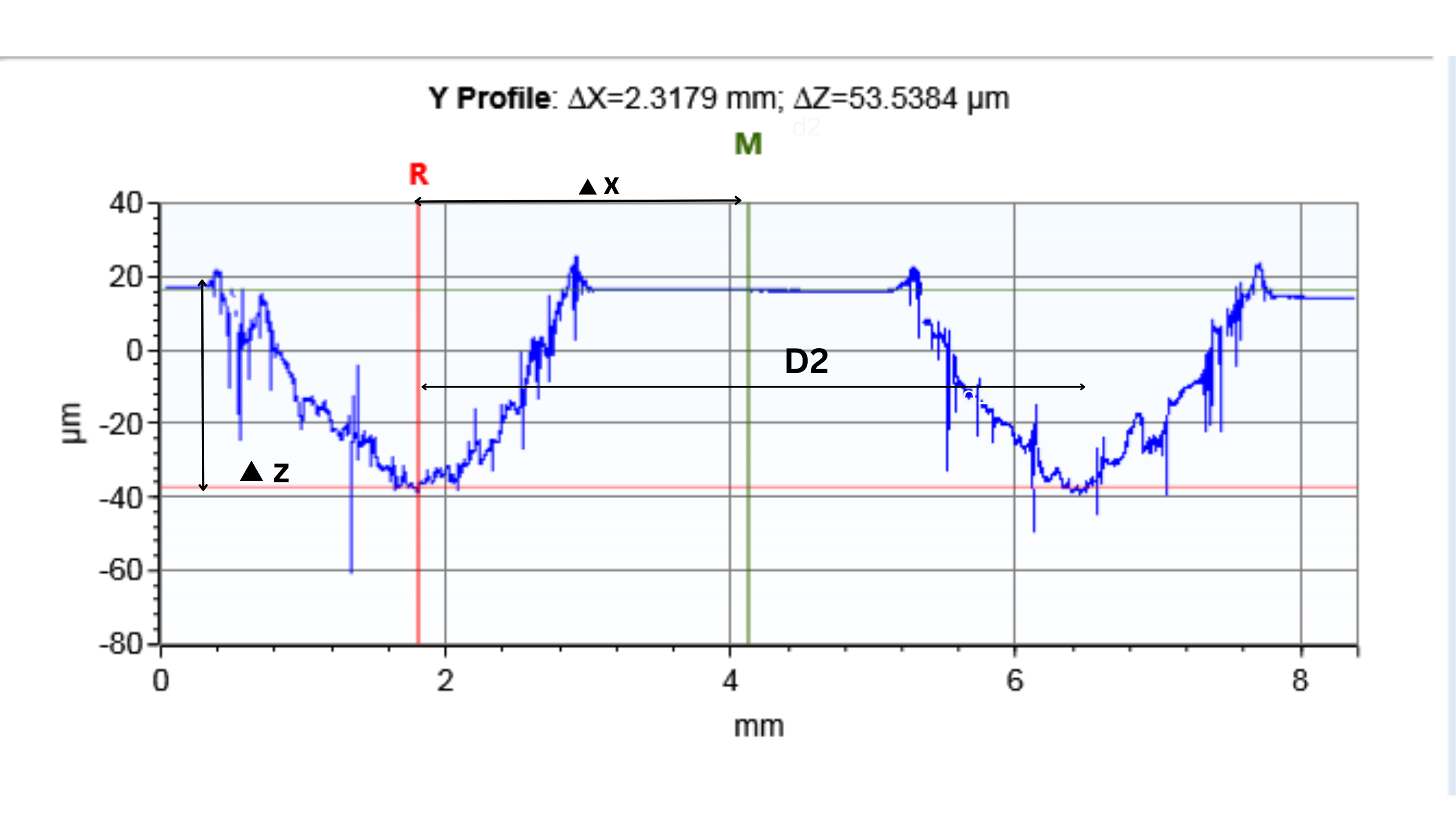 Y Profile